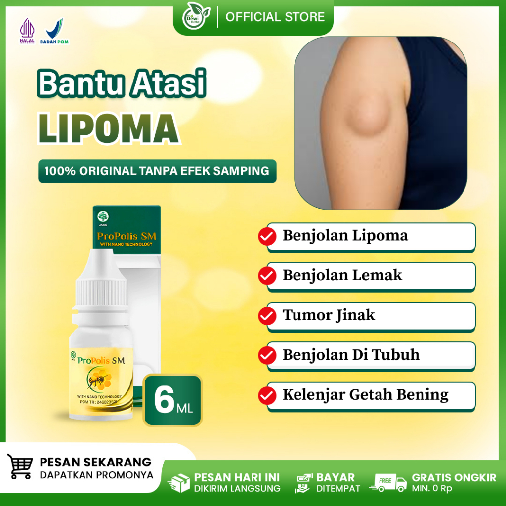 Obat Lipoma Di Punggung, Benjolan Lemak Lipoma Pecah, Tumor Jinak Pada Anak & Dewasa - Propolis SM