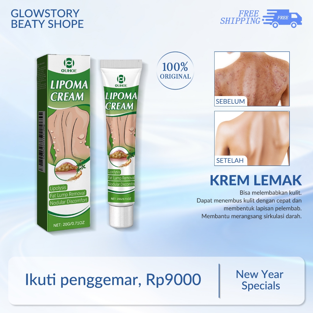 OUHOE Cream Lipoma Salep Benjolan 20g Cream Lipoma Cream Lipoma Original Cream Lipoma Salep Benjolan