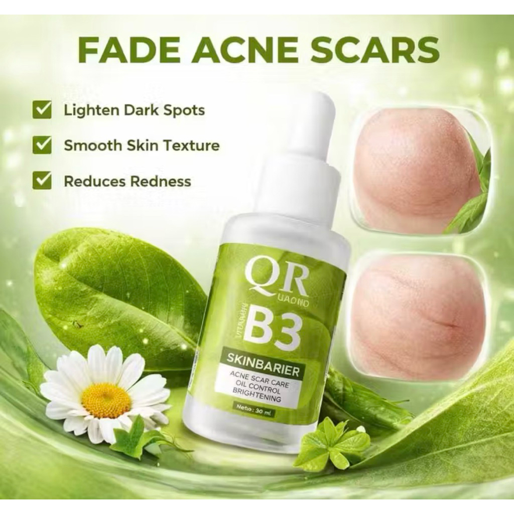QUADRO SERUM B3 MENCERAHKAN MENGHILANGKAN BEKAS JERAWAT