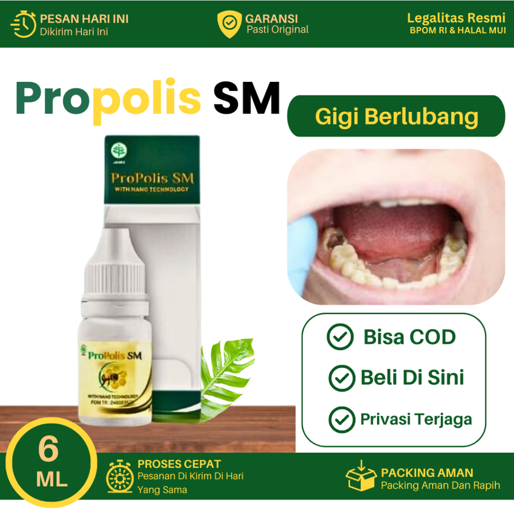 Obat Untuk Gigi Berlubang, Gigi Bolong Gusi, Sakit GiGi Berlubang, Gigi Berlubang Hitam, Gigi Keropo