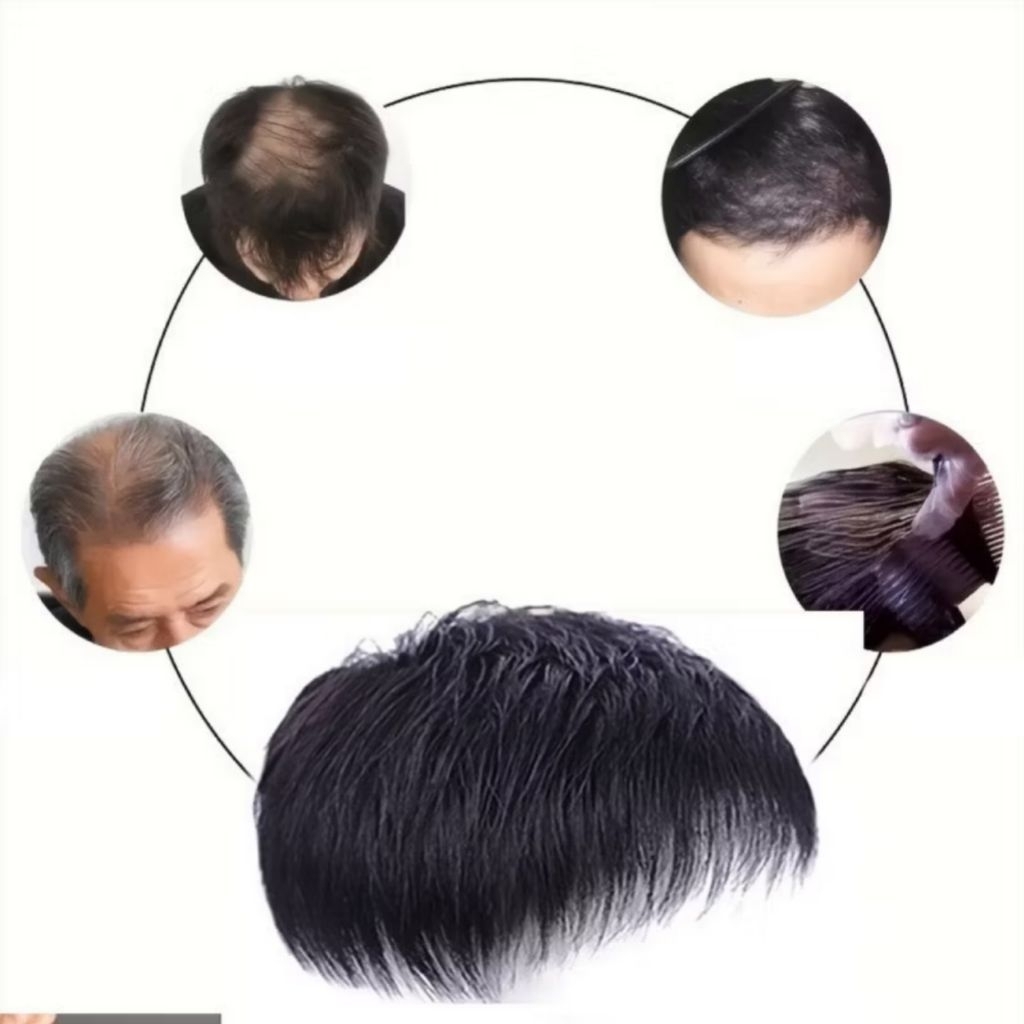 Rambut Palsu Pria Penutup Kebotakan Sebagian Toupee Botak Depan Pria Wig Pria Botak Penutup Rambut B
