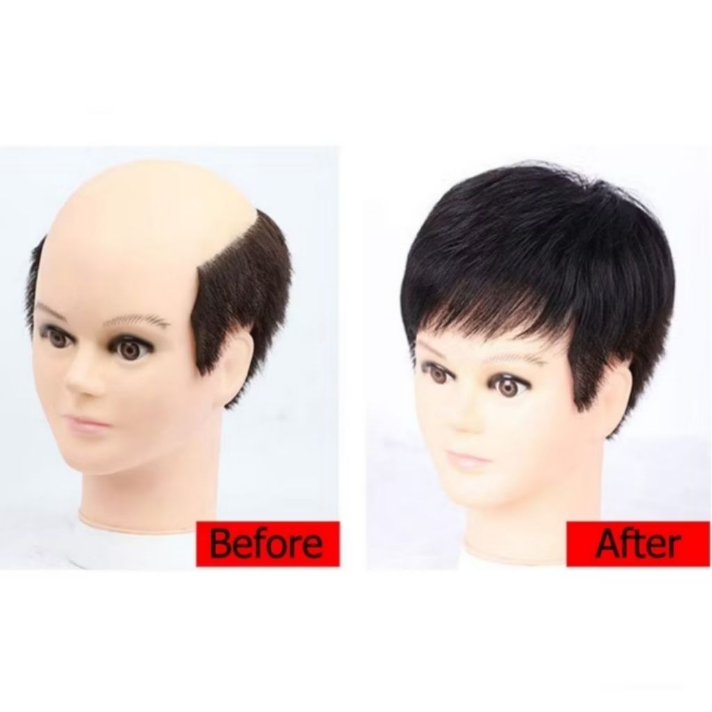 Rambut Palsu Pria Untuk Botak Wig Pria Botak Untuk Penutup Botak Sebagian Toupee Botak Depan Pria