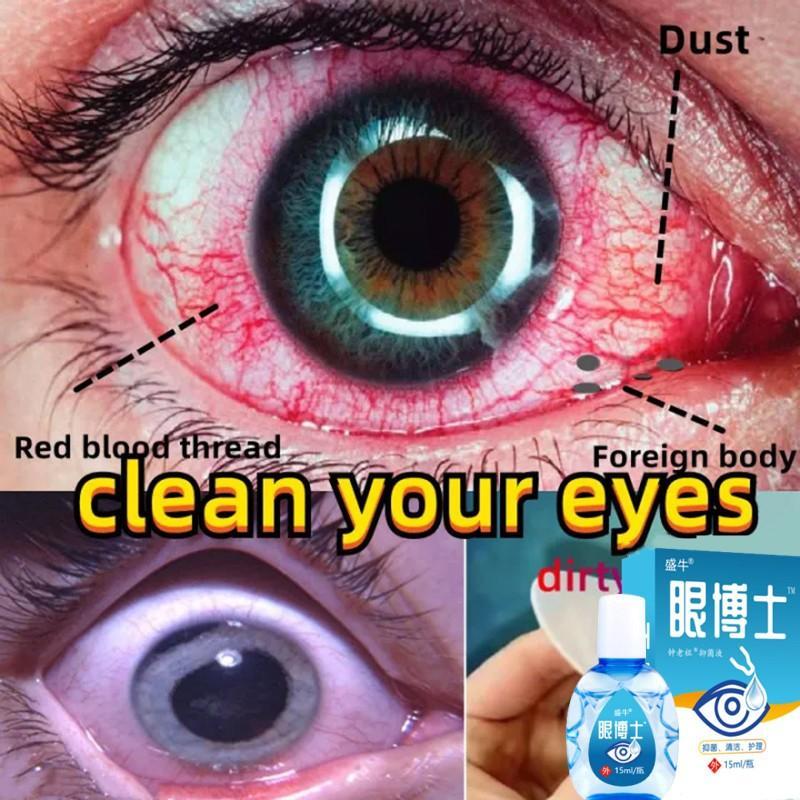 tetes mata, tetes mata Jepang, tetes mata merah Jepang, penutup mata, perawatan katarak, tetes mata 