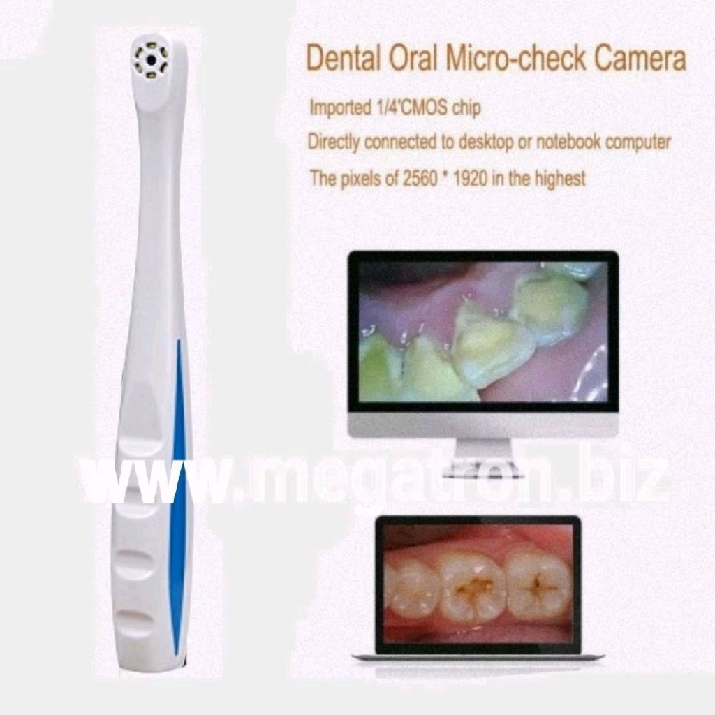 USB Intra Oral Camera - Kamera untuk periksa gigi (Bisa Foto & Video)