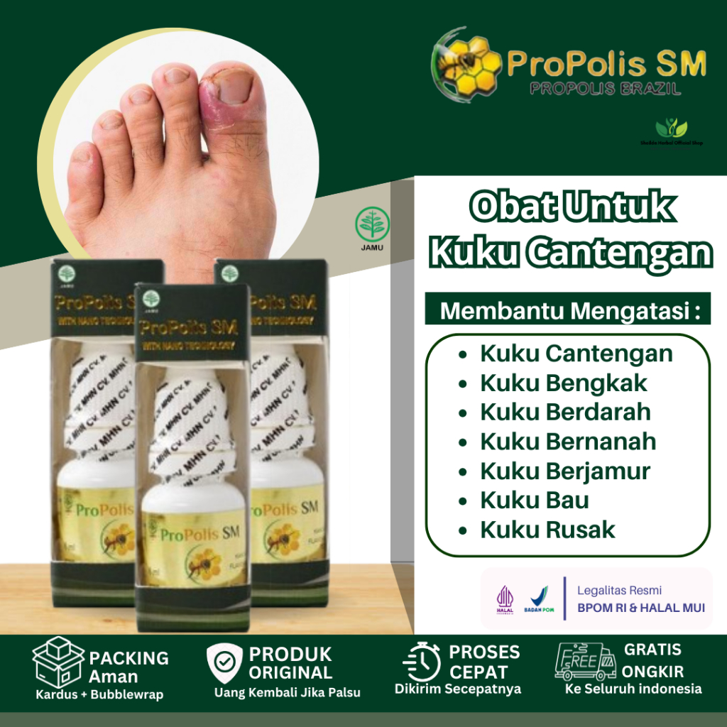 Obat Cantengan Jempol Kaki Kuku Rusak Bengkak Bernanah Berdarah Kuku Jamuran Obat Luka Luar dan Dala