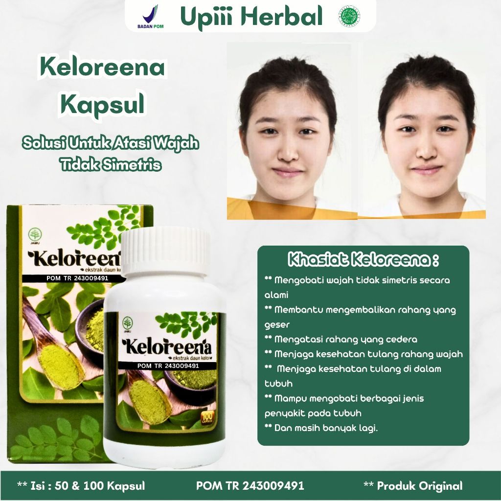 Obat Wajah Tidak Simetris, Obat Untuk Wajah Tidak Simetris, Obat Bibir Miring, Obat Perawatan Bell's