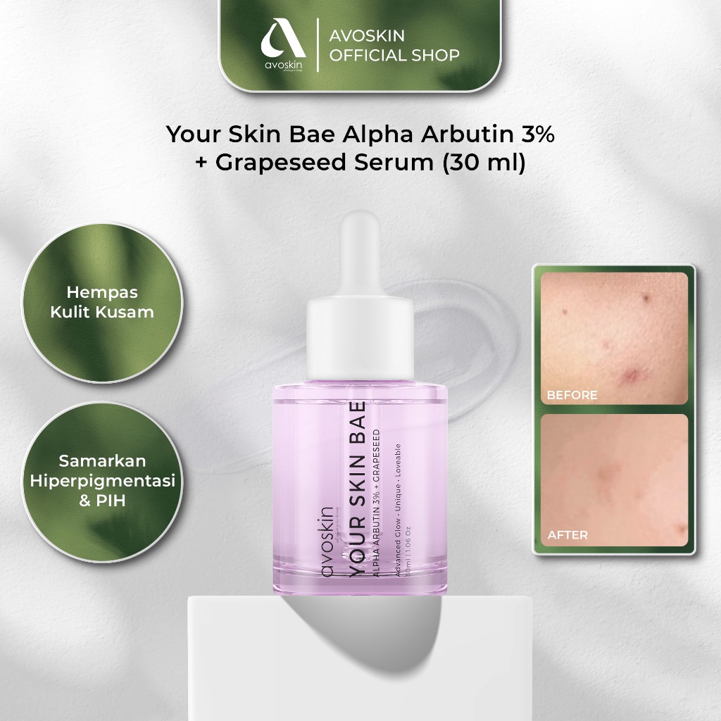 Serum Avoskin Your Skin Bae Alpha Arbutin 30ml-Samarkan Bekas Jerawat, Mencerahkan dan Samarkan Pori
