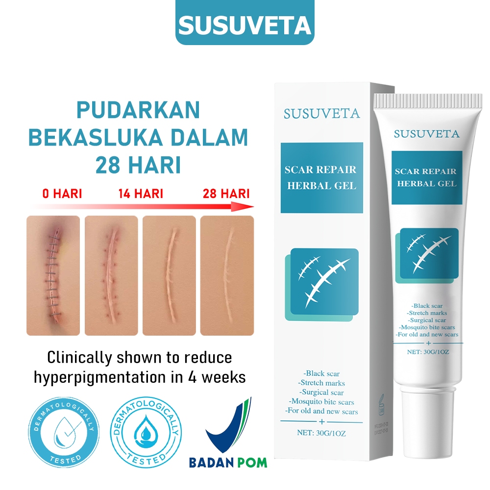 Penghilang bekas luka hitam koreng Obat penghilang bekas luka Penghilang bekas luka Salep penghilang