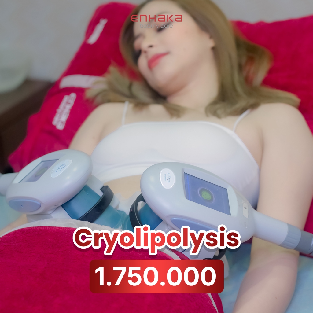 Cryolipolisis Enhaka Medan