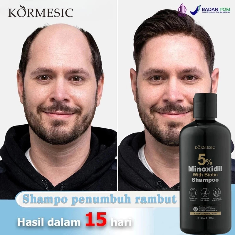 KORMESIC Shampo Penumbuh Rambut Minoxidil 5% Shampo Rambut Rontok Mencegah Rambut Rontok Penumbuh Ra