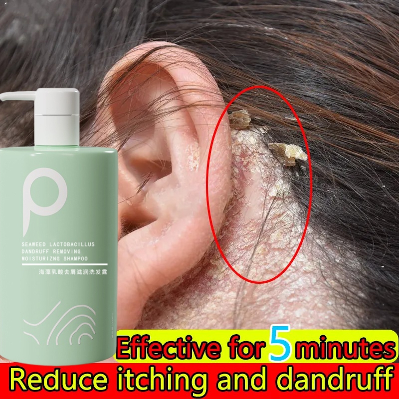 sampo ketombe ampuh sampo anti ketombe dan rontok sampo salon sampo rambut