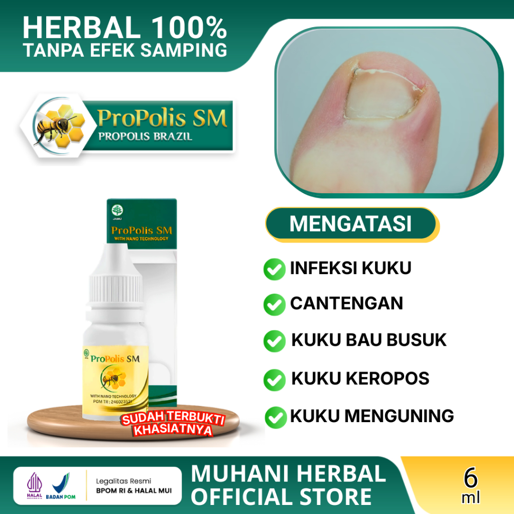 Obat Kuku Anti Infeksi Jamur Bakteri Cantengan Bau Busuk Gatal Menguning Bernanah Sakit Bengkak Mene