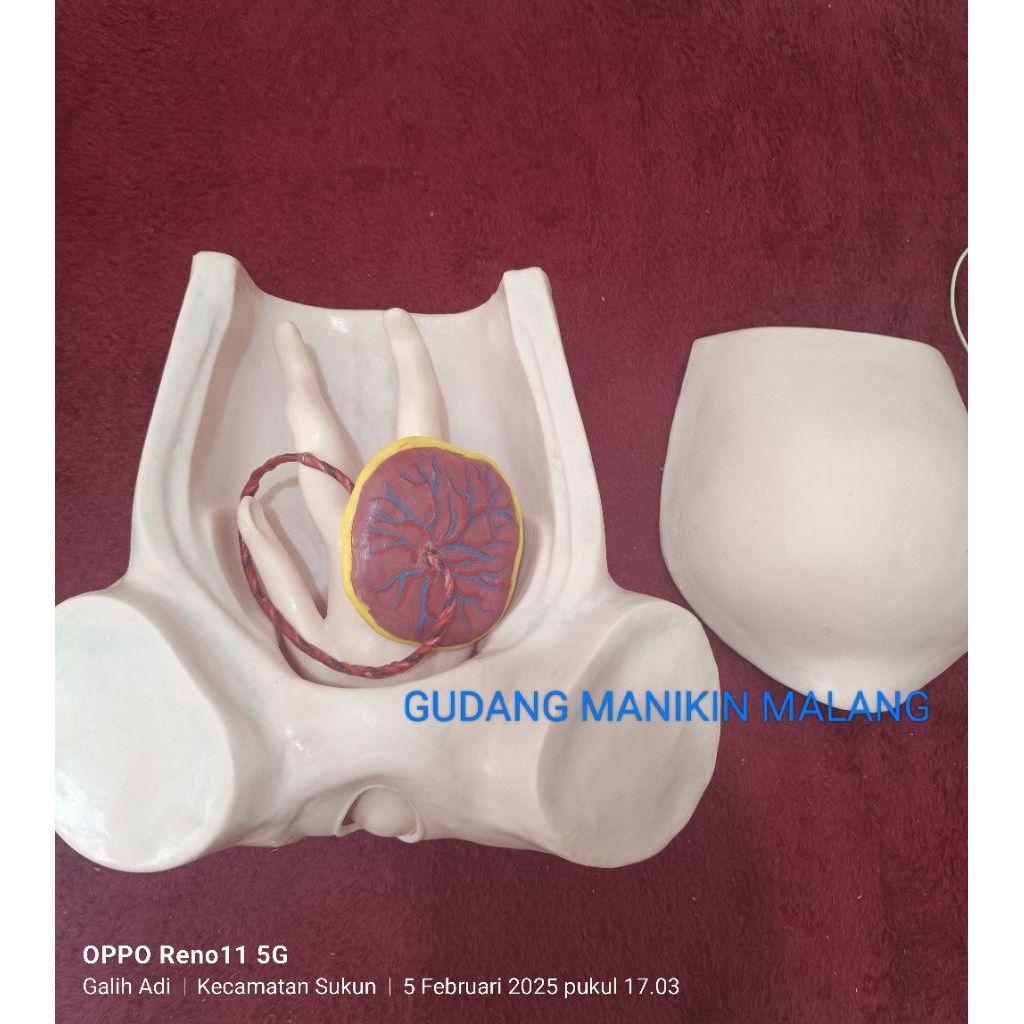 MANIKIN PANGGUL MELAHIRKAN|PHANTOM PERSALINAN|ALAT PERAGA PHANTOM MANEKIN TORSO PANGGUL MELAHIRKAN|I