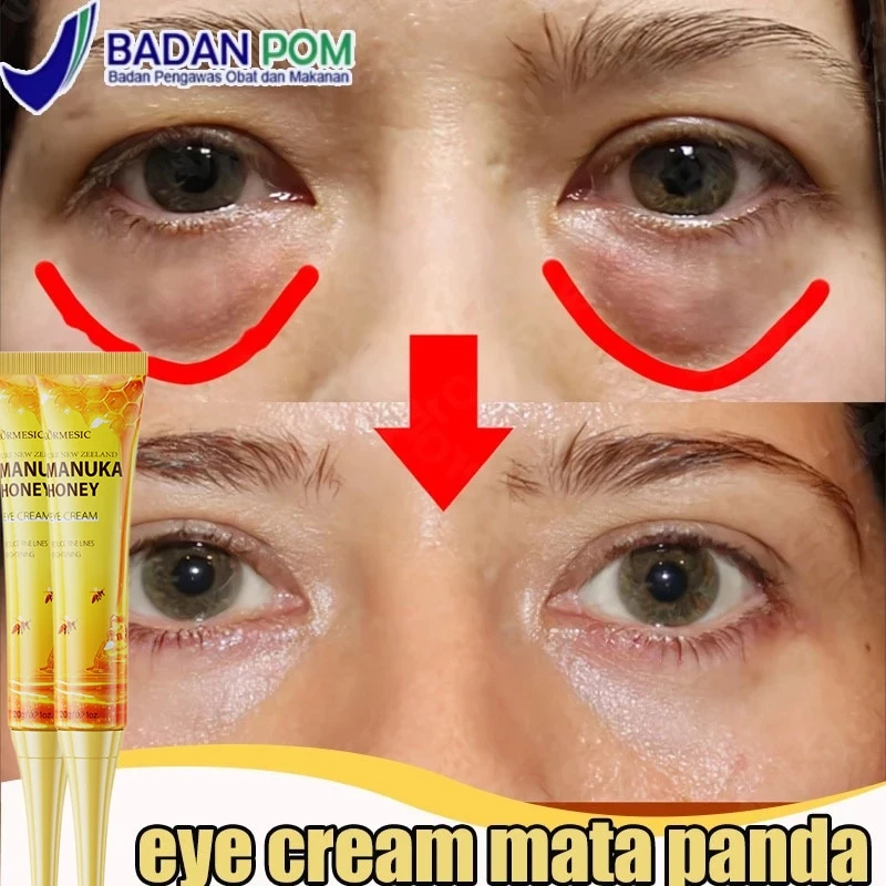 eye cream kantung mata retinol eye cream eye cream retinol Honey Eye Cream