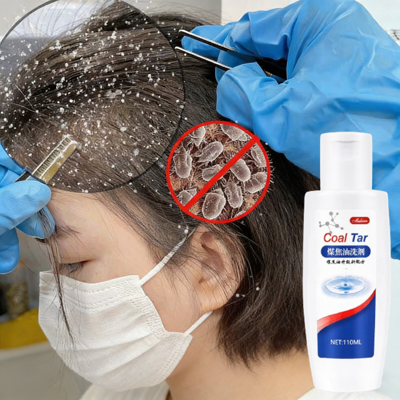 Shampoo kutu rambut Shampo pembasmi kutu anak anak Penghilang kutu rambut sampo kutu ketombe telur k