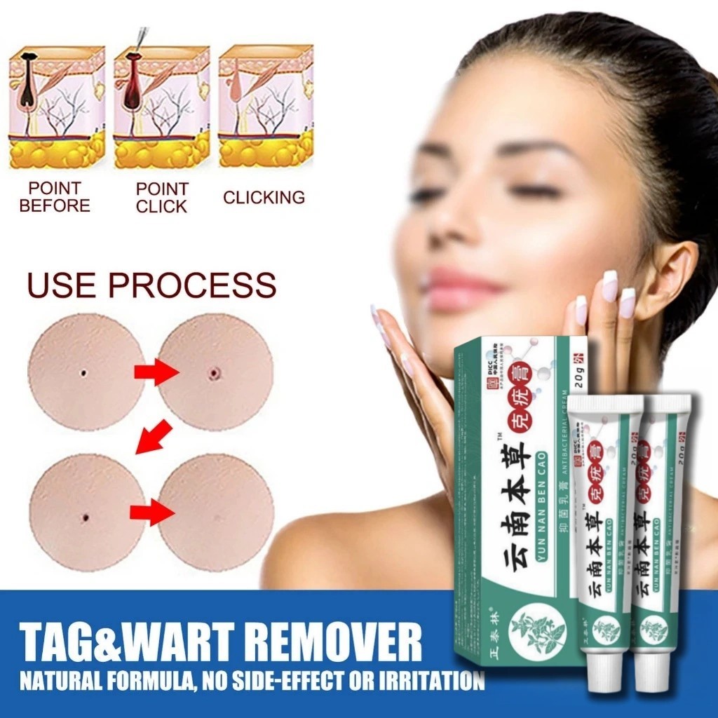 Wart Remover Ointment Wart Treatment Cream Skin Tag Remover Herbal Extract Corn Plaster Wart Ointmen