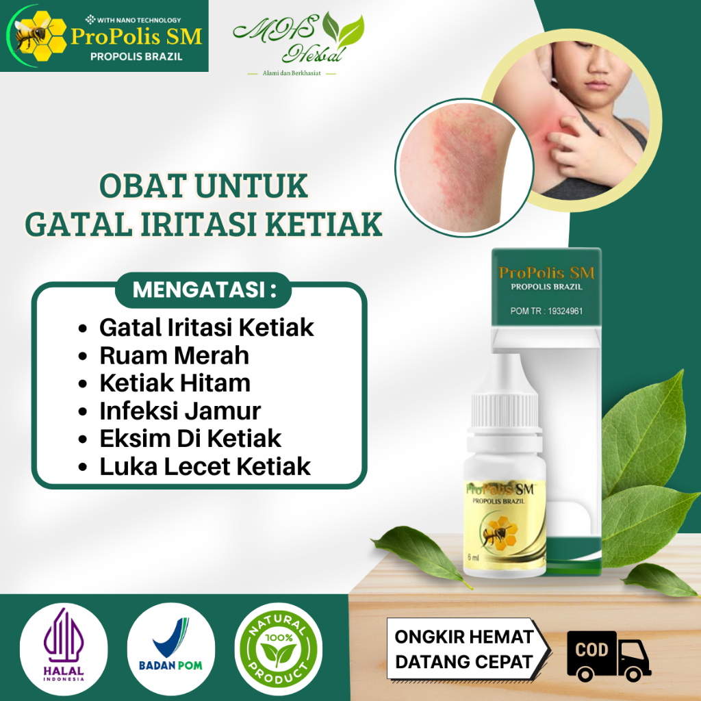 Obat Gatal Iritasi Ketiak, Ruam Merah, Ketiak Hitam, Infeksi Jamur, Eksim Di Ketiak - ProPolis SM Is