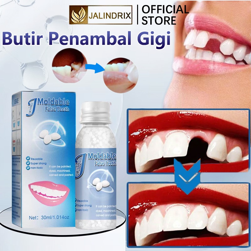 Gigi Palsu penambal gigi berlubang Gigi Penambal Gigi Isi Gigi Palsu Penambal gigi berlubang Gigi pa