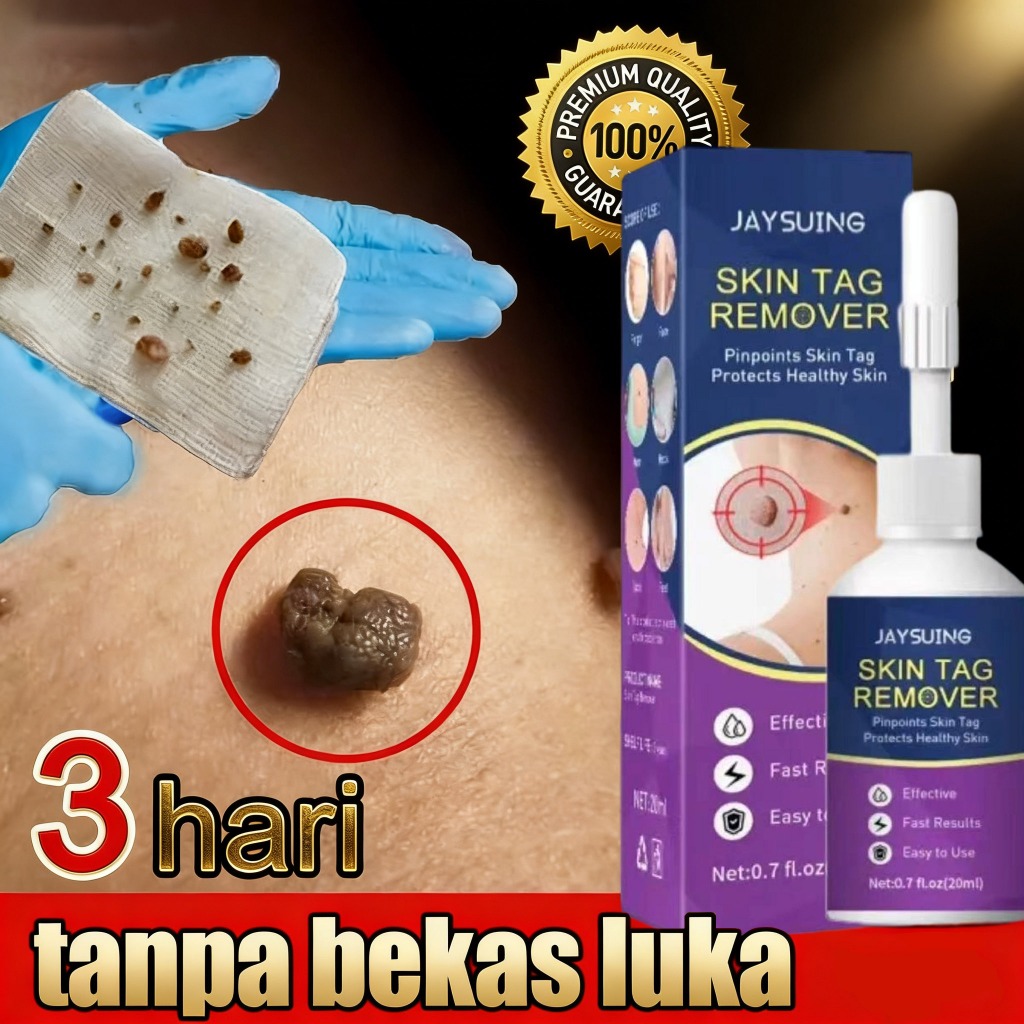 Jaysuing Wart remover cream obat kutil paling ampuh oles obat penghilang kutil obat kutil leher Obat