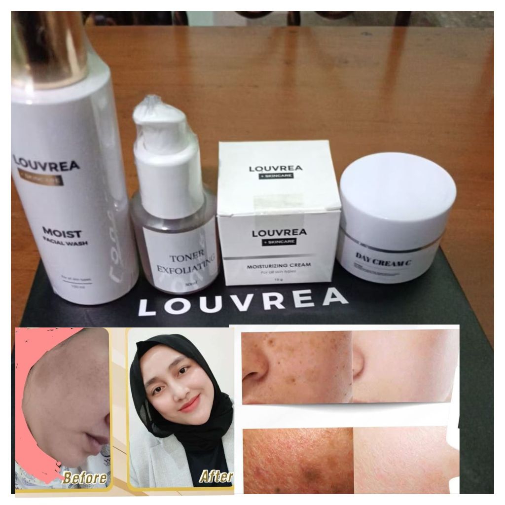 Termurah!!! Paket anti flek Louvrea skincare