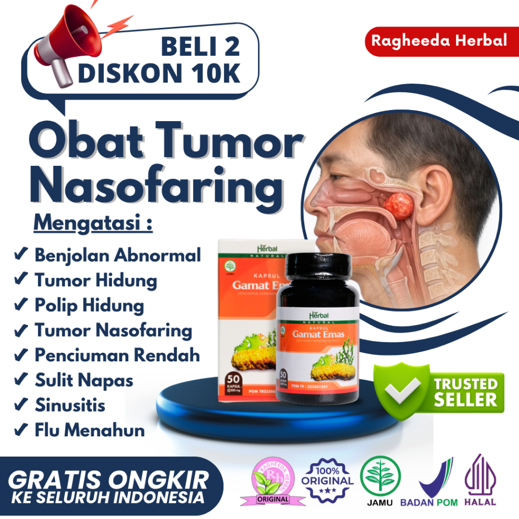 Obat Tumor Jinak Hidung - Tumor Nasofaring Benjolan Lunak Kenyal, Tidak Nyeri, Mengganggu Pernapasan