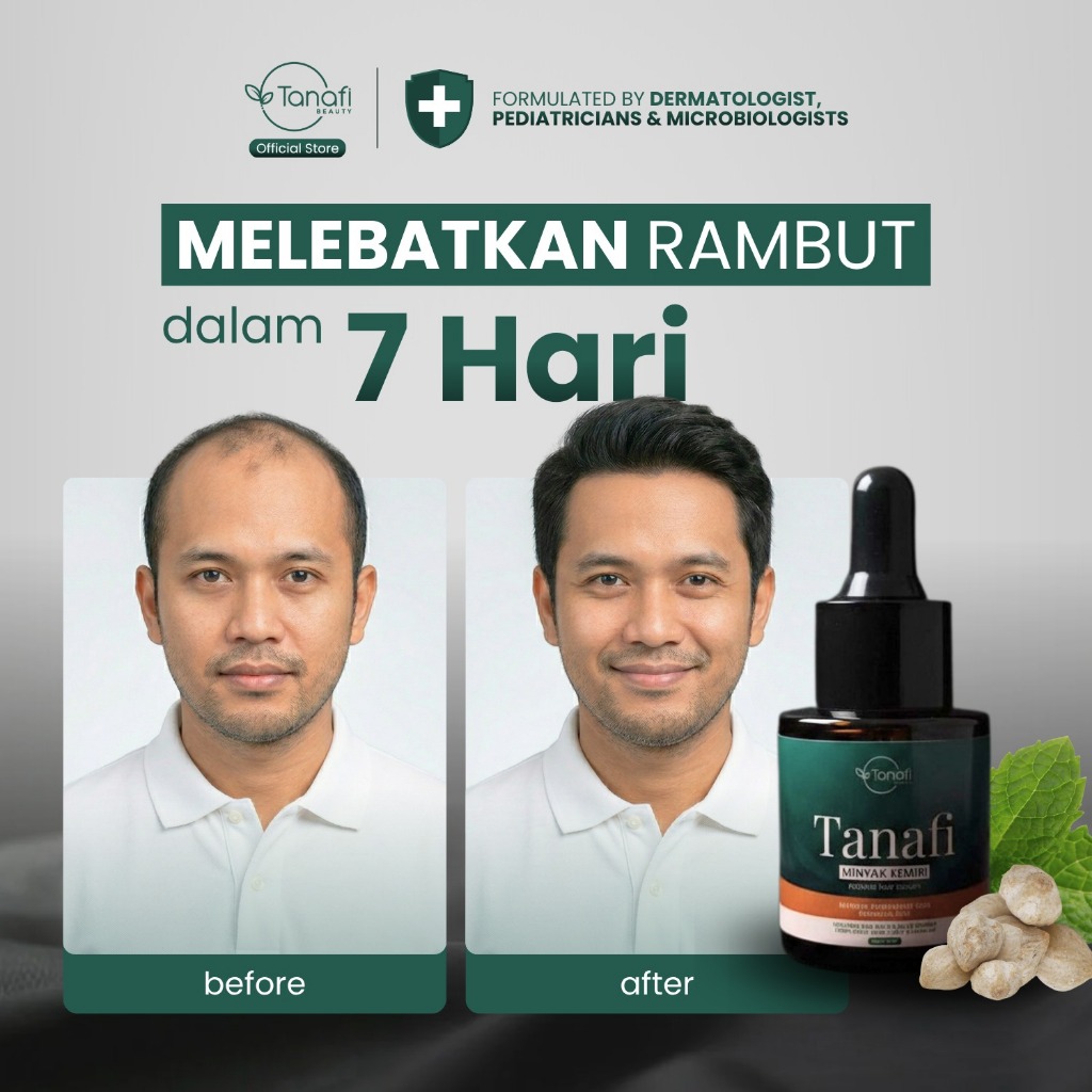 Serum Penumbuh Rambut Botak Depan Super Cepat Original Tanafi Natural Hair Serum Serum Penumbuh Ramb