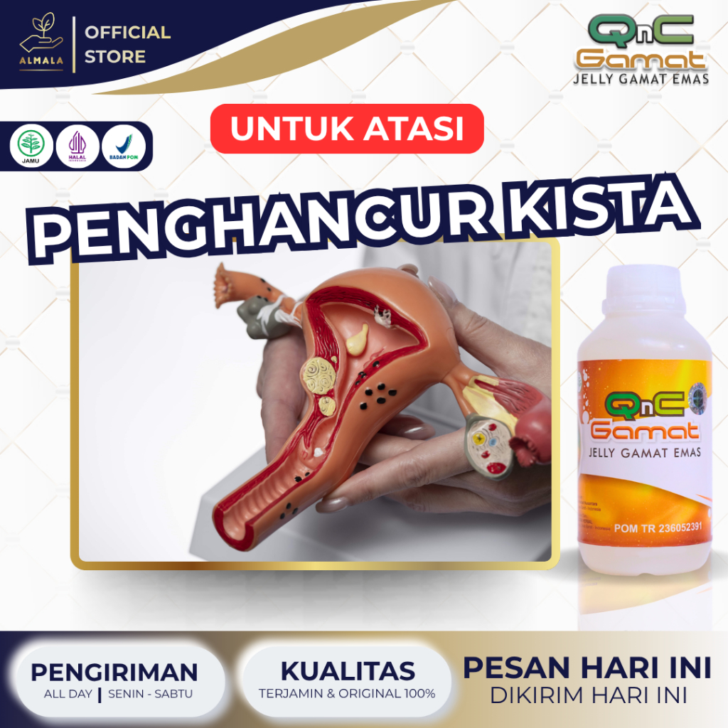Obat Penghancur Kista Baker, Obat Kista Baker, Obat Alami Kista Baker, Obat Benjolan Di Belakang Lut