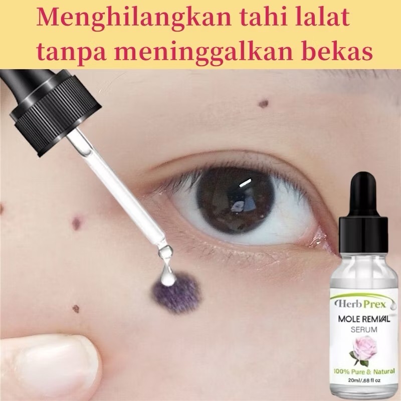 Serum Penghilang Tahi Lalat & Kutil 20ml - Skin Tag Remover Hilangkan Flek Hitam Tanpa Luka