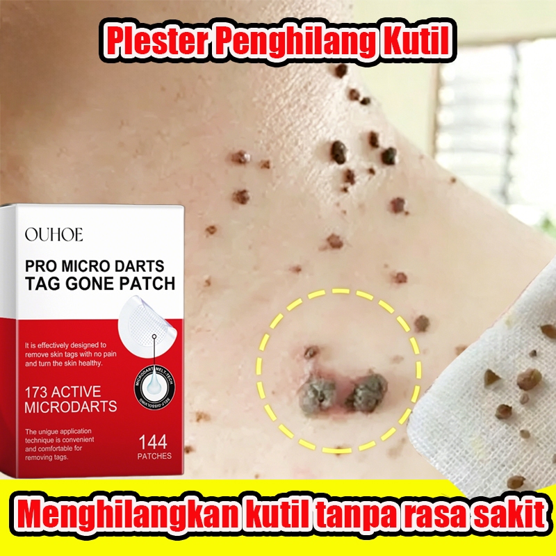 Stiker Penghilang Kutil Dan Tahi Skin Tag Patch 144pcs Lalat Penghilang Kutil Di Leher Penghilang Ta