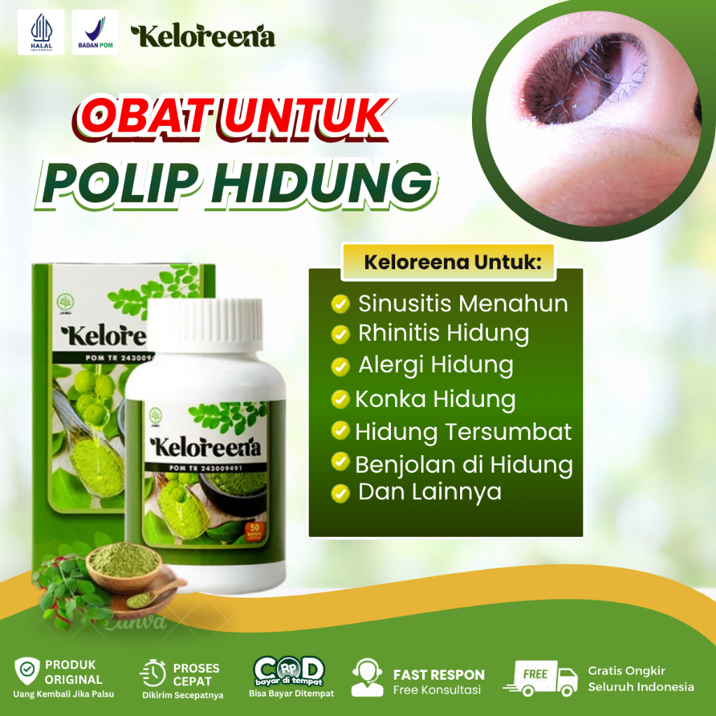 Obat Polip Hidung, Sinusitis Menahun, Rhinitis, Alergi Hidung, Hidung Tersumbat, Konka Hidung, Benjo