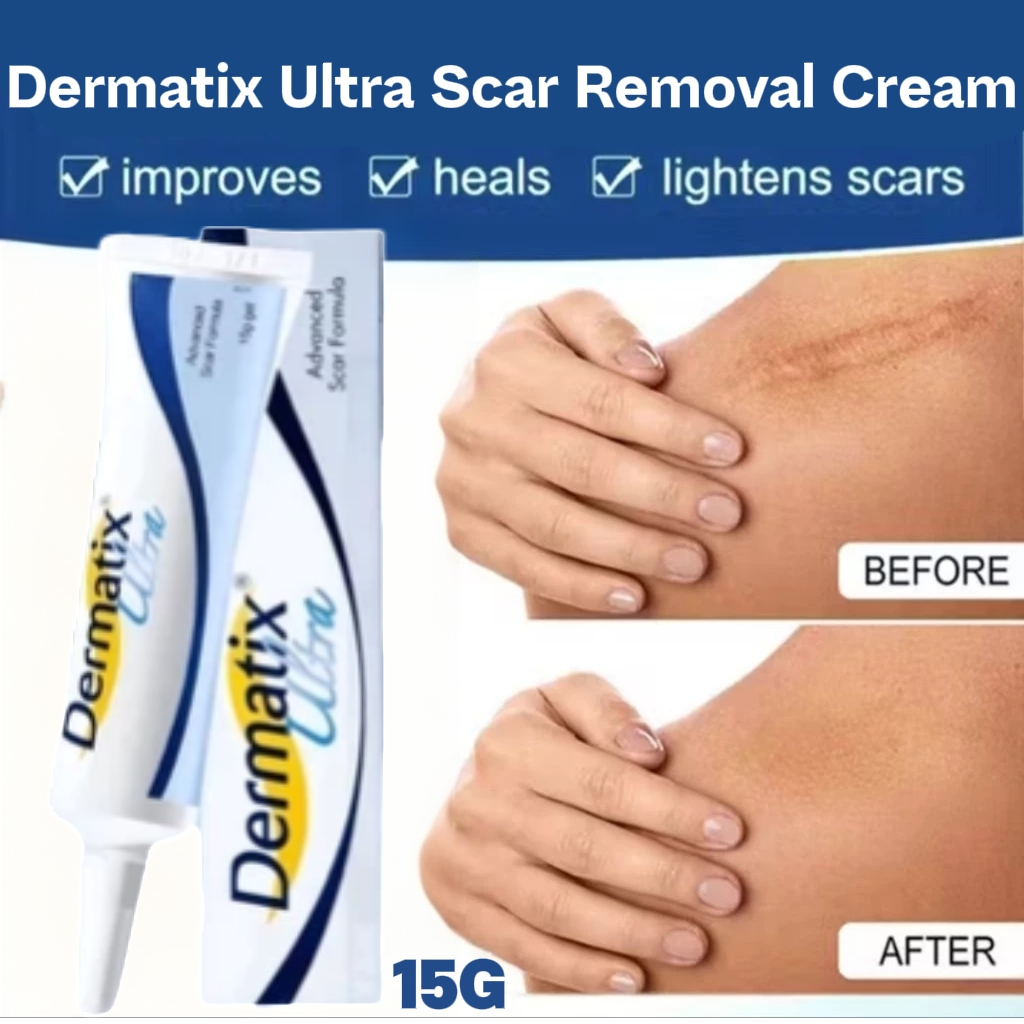 *ORI EXP2028 Beli 2 gratis 1* - Dermatix Ultra Scar Removal Cream 15gr Penghilang Bekas Luka - Treat