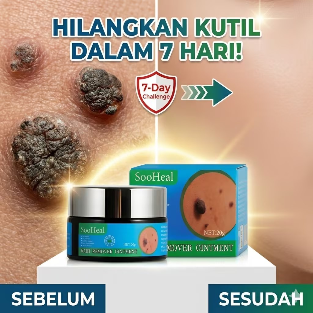 Salep penghilang kutil,20g,Penghilang kutil di wajah,Callusol kutil