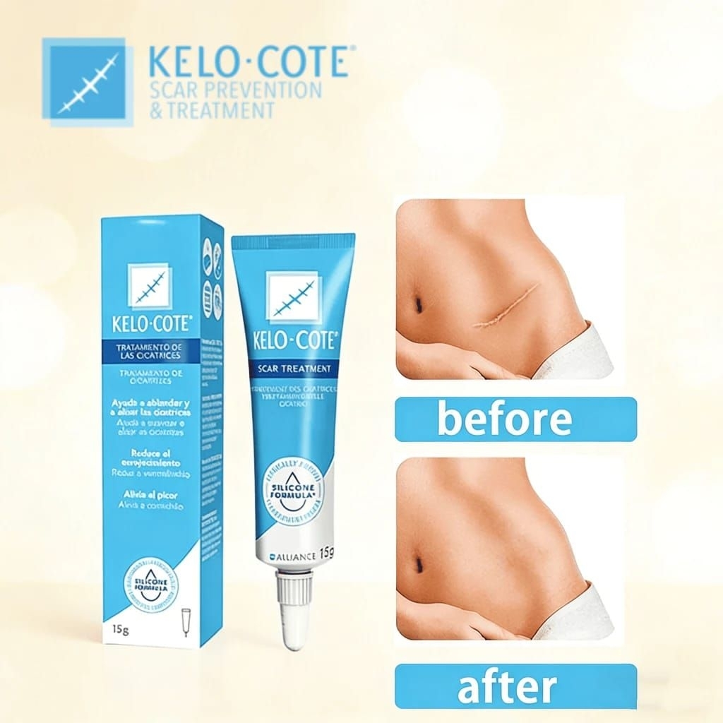 Kelo Cote Original Advanced Formula Scar Gel 15g/Kelo-Cote U.S.Edition Scar removal Gel Penghilang B
