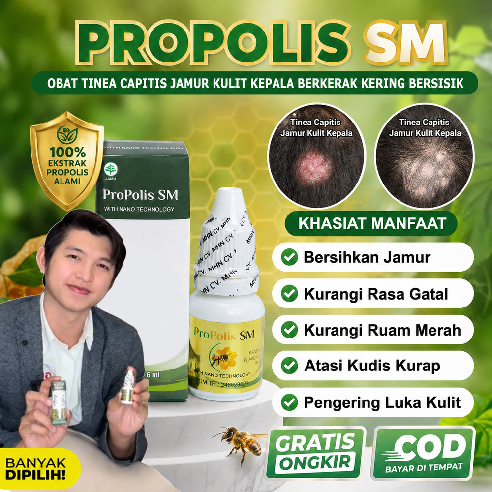 Obat Tinea Capitis Jamur Kulit Kepala, Kulit Kepala Berkerak Kering Bersisik, Rambut Rontok, Pitak, 