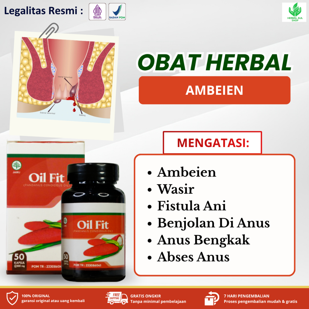 Kapsul Oilfit Obat Ambeien, Wasir, Fistula Ani, Pengempis Benjolan Di Anus, Anus Bengkak, Abses Anus