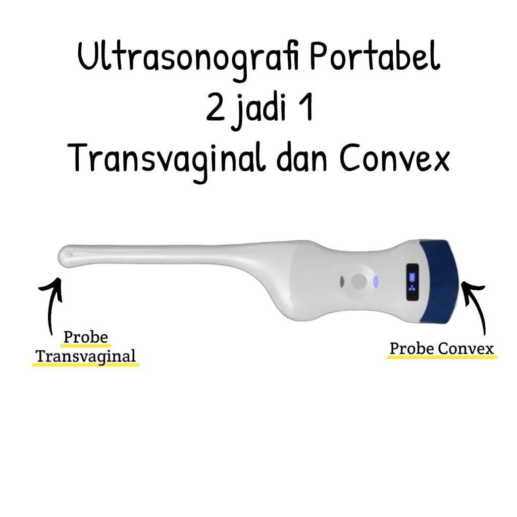 Alat USG Wireless Portable Dual Probe - Scanner Ultrasonik Nirkabel Convex & Transvaginal | Alat Pem