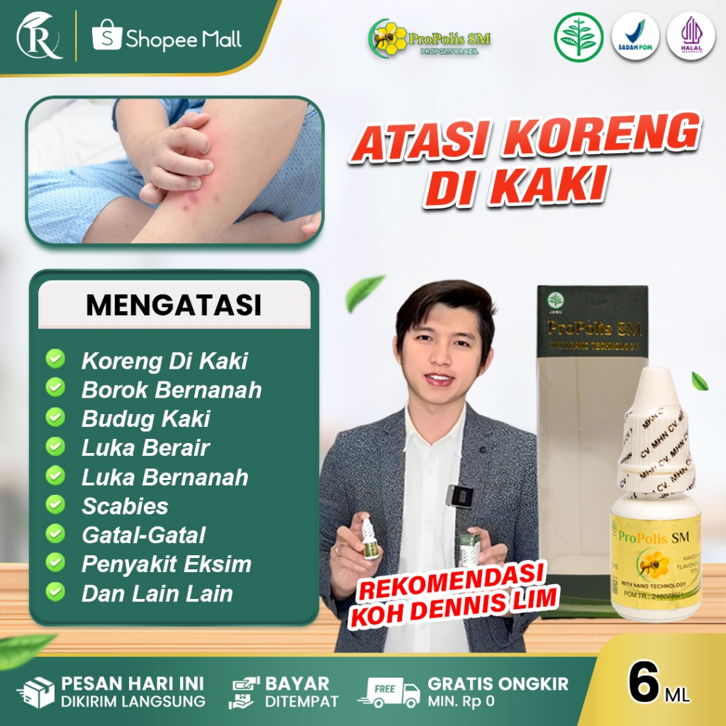 Obat Koreng Di Kaki / Borok Bernanah Di Kaki Budug Kaki Luka Berair dan Bernanah dengan Propolis SM