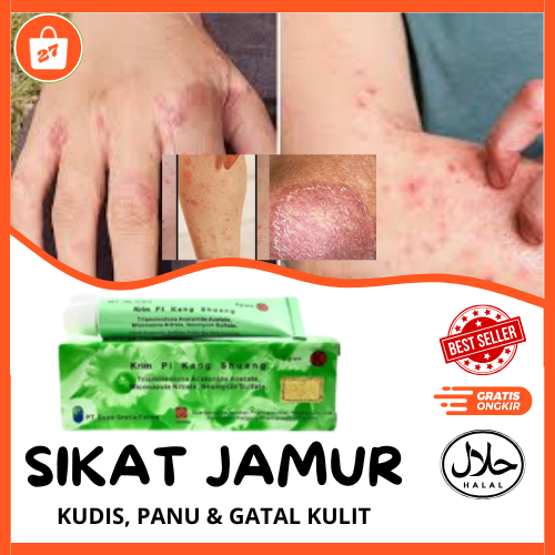 Pi Khang Suang Obat Salep Untuk Kulit Kurap Kudis Kutu Air Jamur Kulit Parah Sudah BPOM