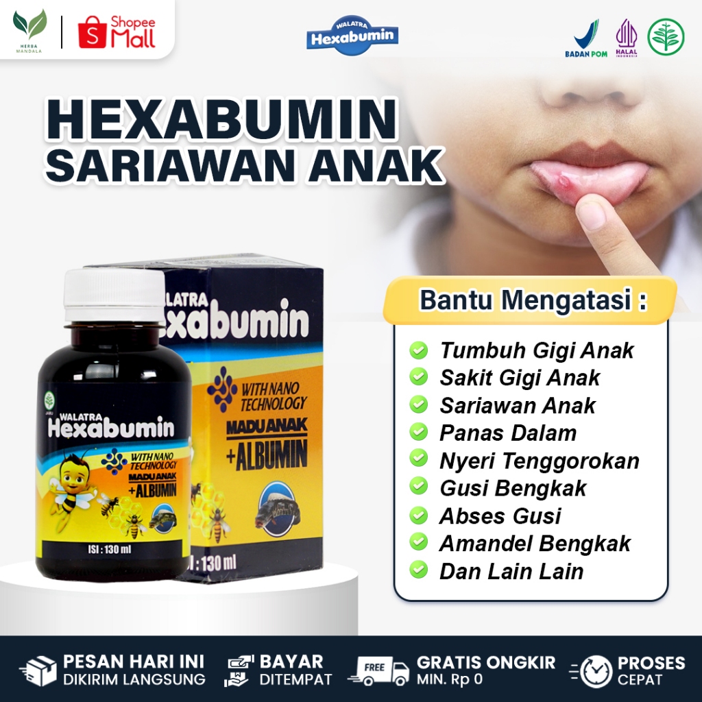 WALATRA HEXABUMIN Obat Sariawan Anak Lidah Perih Sariawan di Lidah / Bibir Panas Dalam