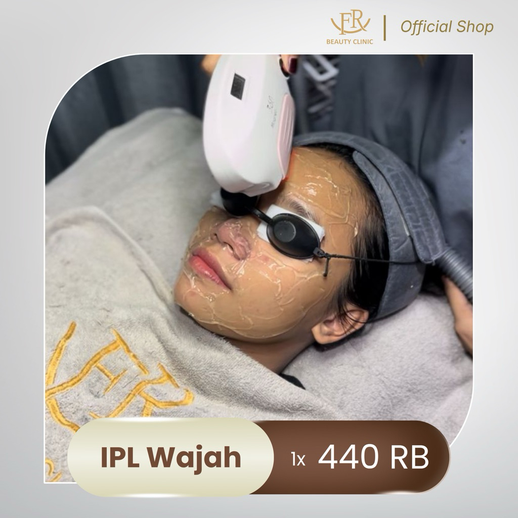 FR Beauty IPL Wajah