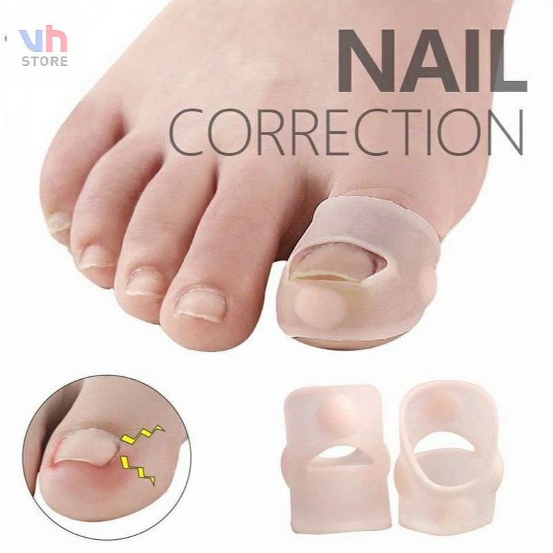 Alat Koreksi Kuku Kaki Tumbuh Ke Dalam Bahan Silikon Elastis Cantengan
