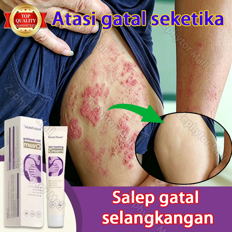 Salep Gatal Selangkangan Salep Eksim Kering Dan Gatal Obat Gatal Kulit Psoriasis Cream Skin Soothing