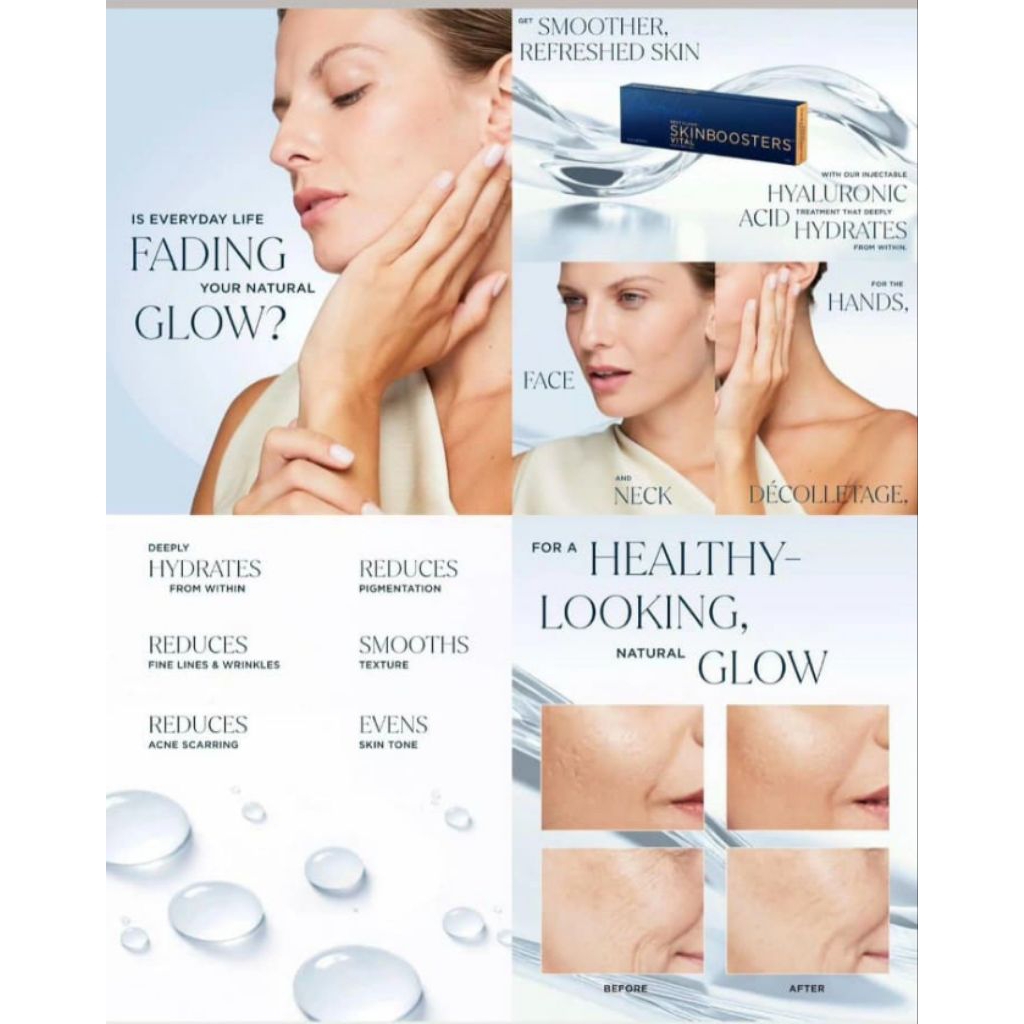 Restylane skin booster VitaL light
