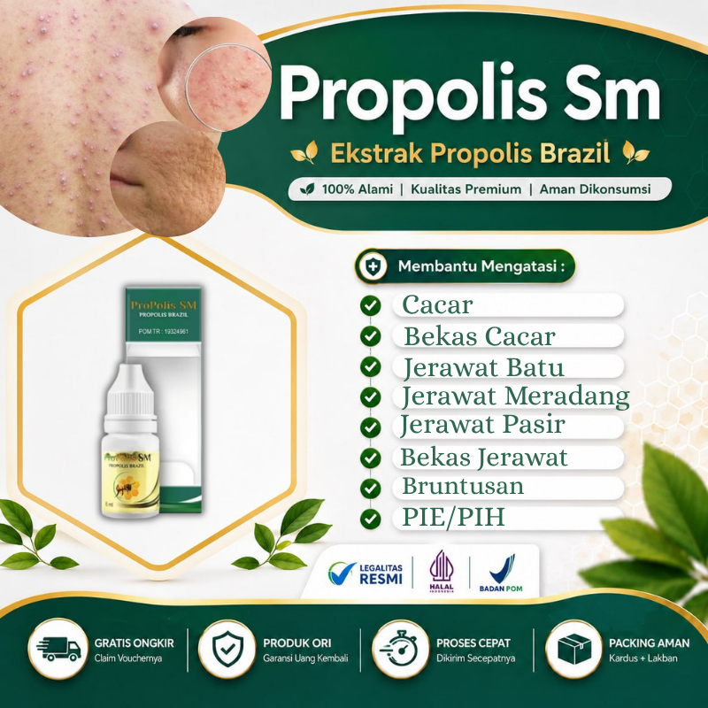 Propolis SM - Obat Tetes Jerawat Jerawat Batu Menyamarkan Bekas Jerawat PIE PIH Beruntusan Cacar Bek