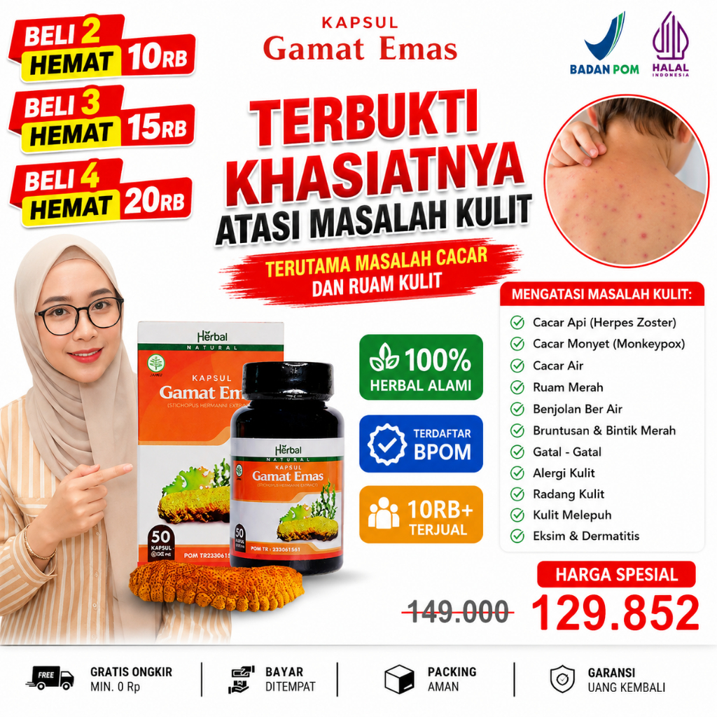 Obat Cacar Api cacar Air Cacar Ular Cacar Monyet Pengering Cacar Tanpa Efek Samping