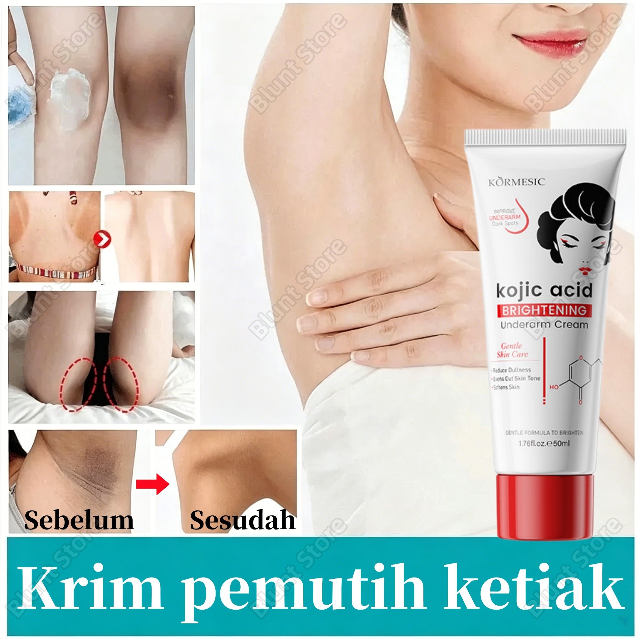 BPOM Krim Pemutih Ketiak Dan Selangkangan Cream Pemutih Hitam Underarm Miss V Pencerah Brightening M