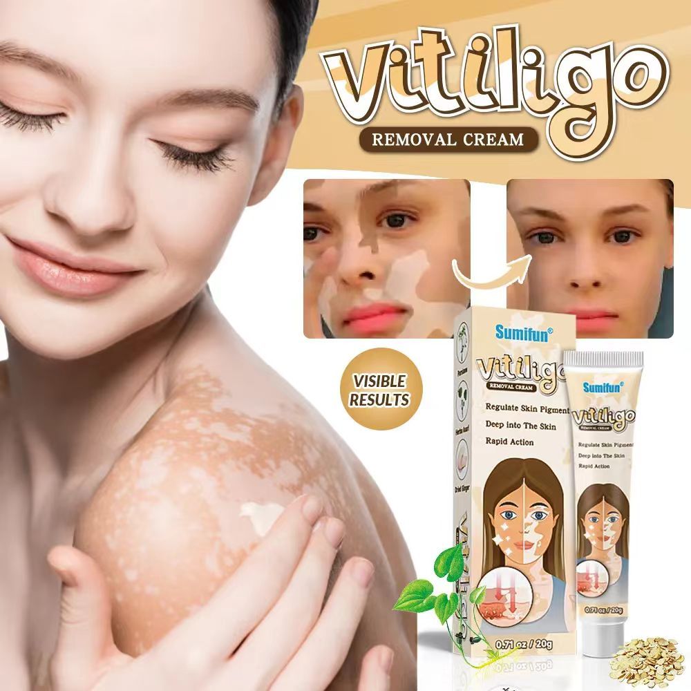 Krim Vitiligo Sumifun salep bercak putih di kulit Salep bintik putih khusus vitiligo cepat menghilan
