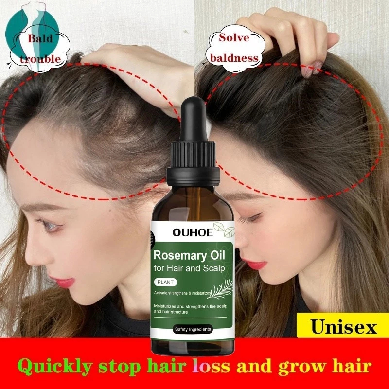 rosemary oil rambut hair oil rosemary hair tonic rosemary hair oil rambut rontok dan kering hair oil
