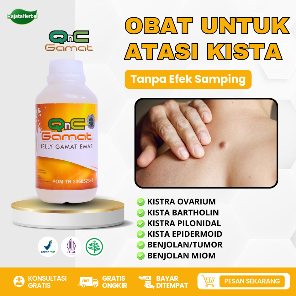 Obat Kista Ovarium Kista Bartholin Kista Epidermoid Endometriosis Penghilang Benjolan Miom Asli Orig