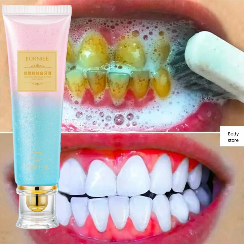 odol pemutih gigi dan karang gigi pembersih karang gigi tooth refresh toothpaste pasta gigi whitenin